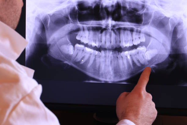 Best Emergency Treatment for Toothache in Westke, LA