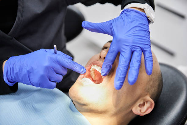 Best Walk-In Emergency Dentist in Westke, LA